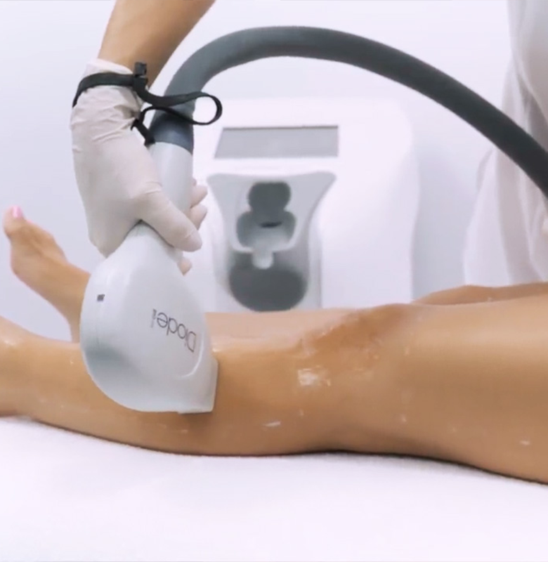 Hair Removal Laser with Ultra Diode Machine